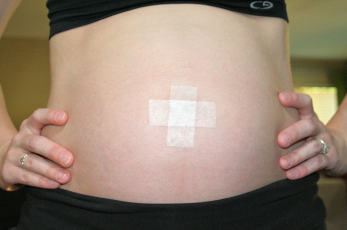 Yeast Infection Belly Button Over The Counter Treatment