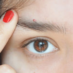 what causes pimple on eyebrow