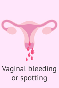 Learn About Brown Spotting or Discharge After Period