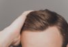 hair transplant cost and treatment